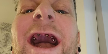 Hepimiz kana kana içiyoruz ama dişleri eritiyor: Ne kola ne çay