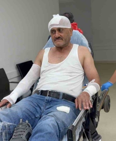 alevler-icinde-kaldi-dereye-atlayarak-yanmaktan-kurtuldu