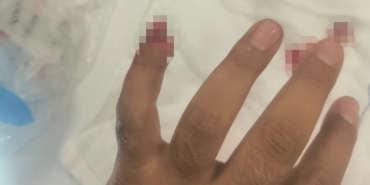 yasakli-maddeyle-yakalandi-polisin-parmagini-isirarak-kopardi