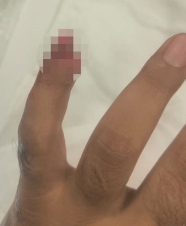 yasakli-maddeyle-yakalandi-polisin-parmagini-isirarak-kopardi