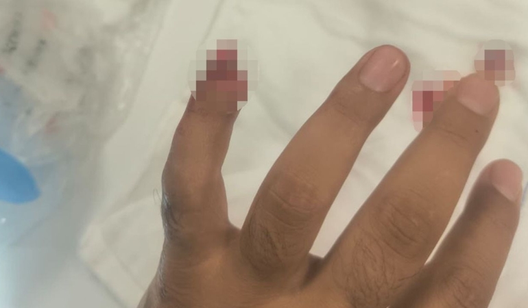 Yasaklı maddeyle yakalandı, polisin parmağını ısırarak kopardı