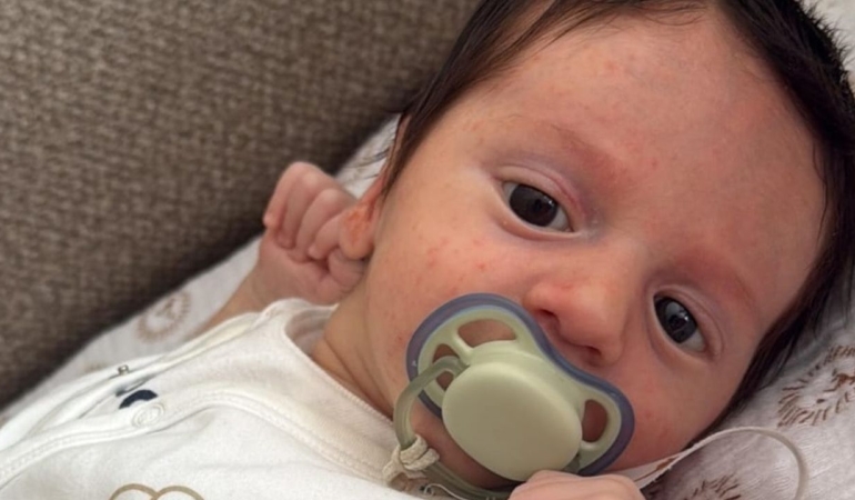 Sinoplu Minik Uras yaşamak için destek bekliyor