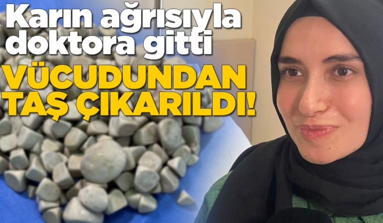 Vücudundan 287 adet taş çıkarıldı